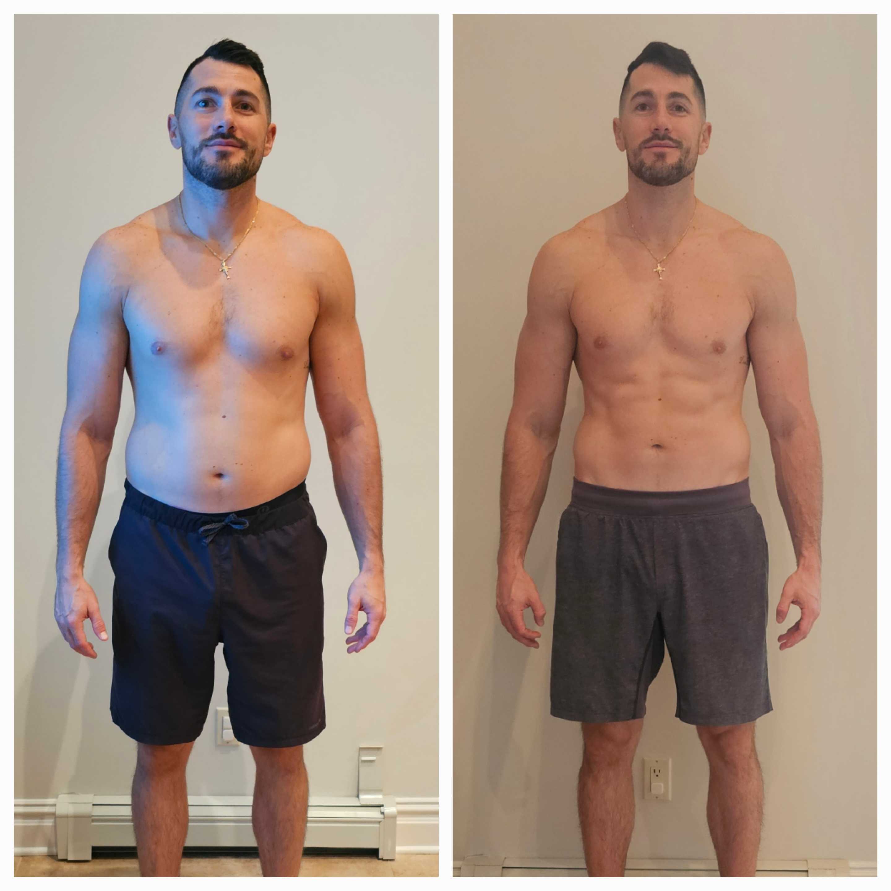 Real Patient Results - Bill